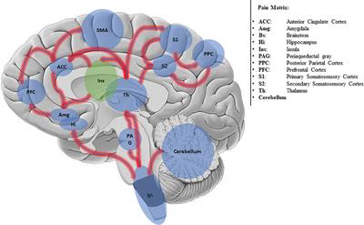 Addressing Pain for a Proper Rehabilitation Process in Patients With Severe Disorders of Consciousness